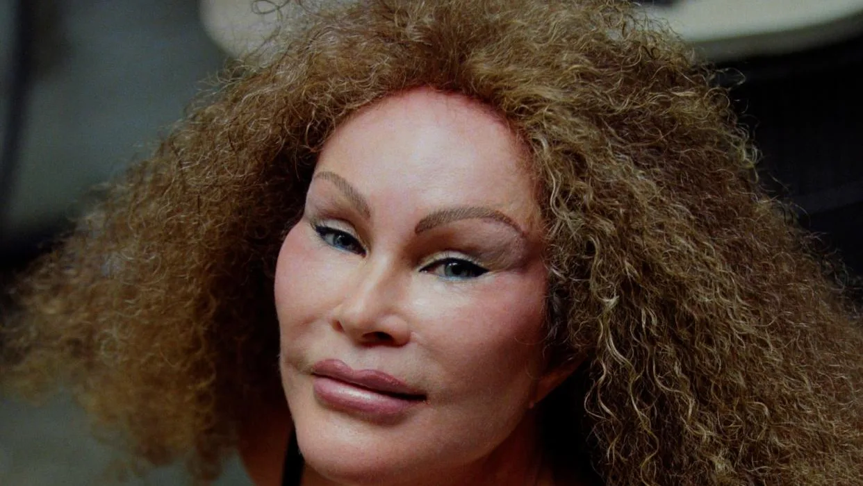 Catwoman Jocelyn Wildenstein Hayatını Kaybetti